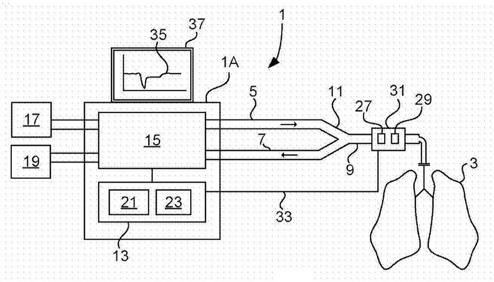 Ventilation pattern for hemodynamic parameter determination during mechanical ventilation