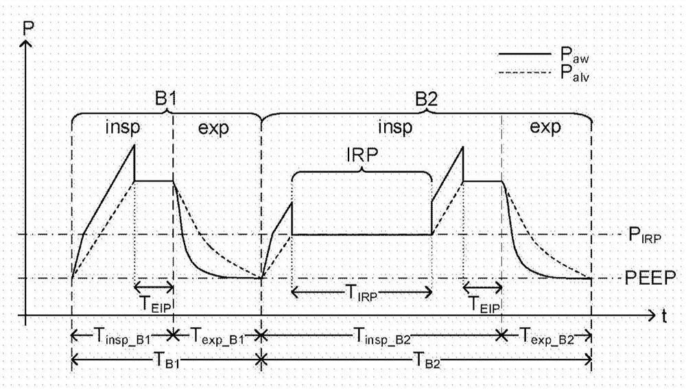 Ventilation pattern for hemodynamic parameter determination during mechanical ventilation