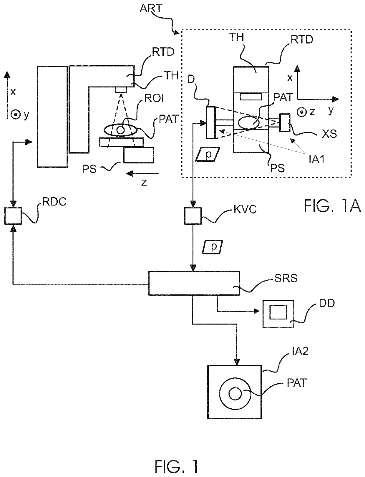 Automated detection of lung conditions for monitoring thoracic patients undertgoing external beam radiation therapy