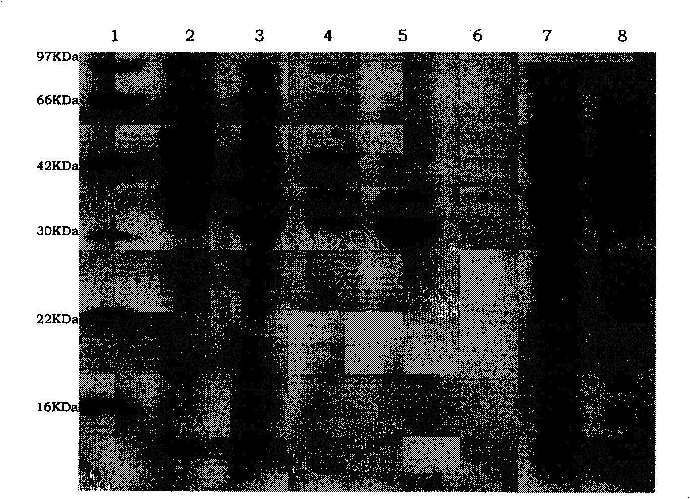 A Mycoplasma hyopneumoniae recombinant antigen ELISA detection kit