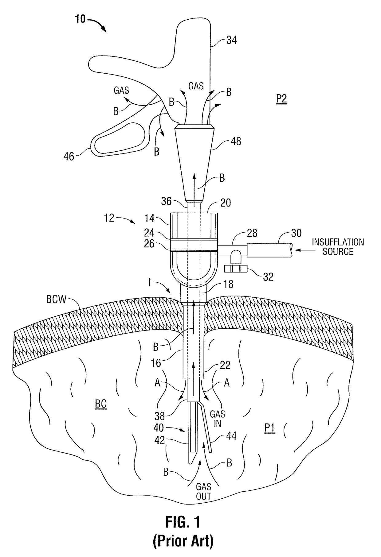 Internally pressurized medical devices