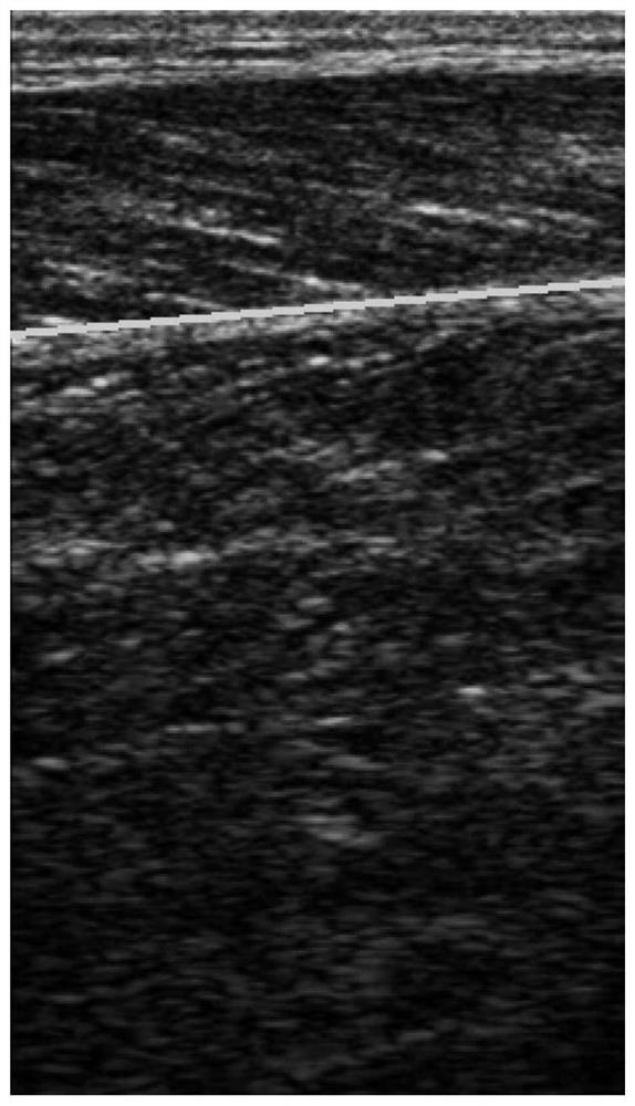 Method for detecting lower muscular fascia and included angle between lower muscular fascia and muscle fiber based on B-mode ultrasound image