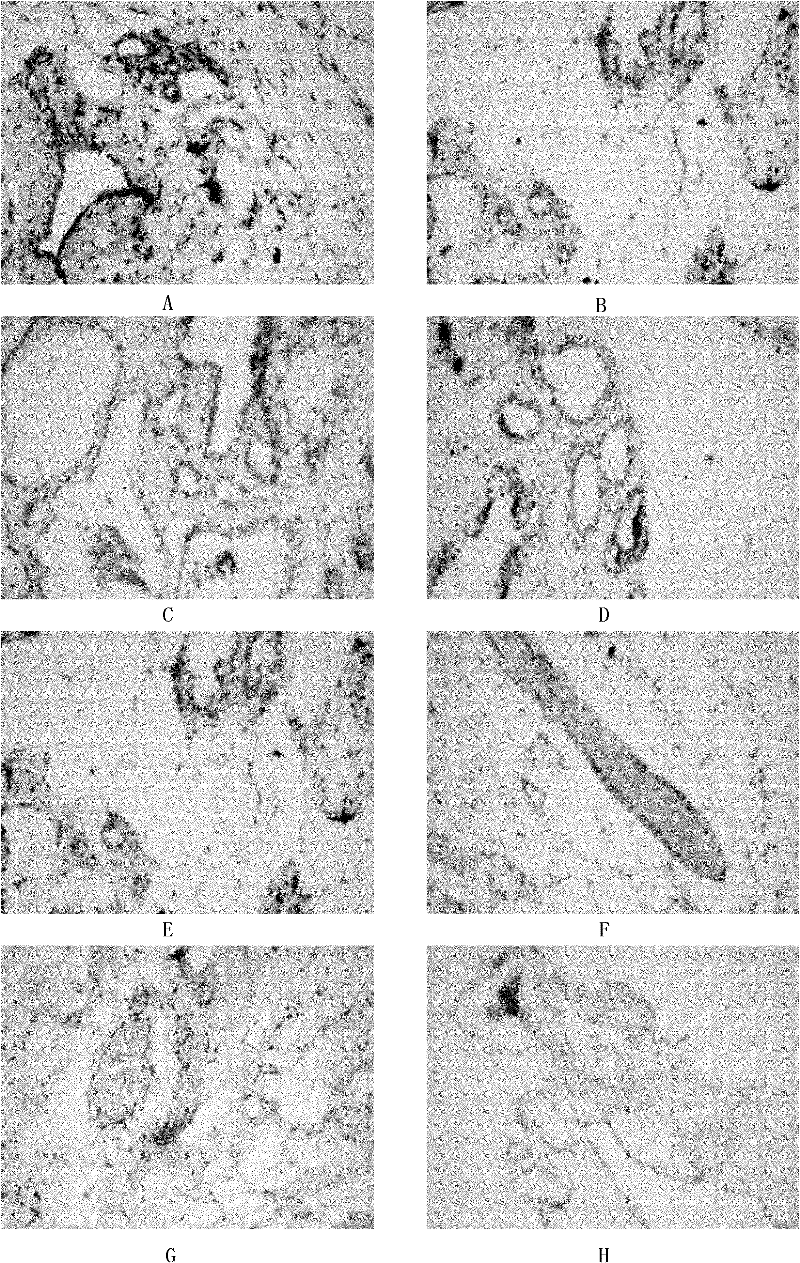 Cream preparation for preventing and curing mammary gland hyperplasia and preparation method thereof