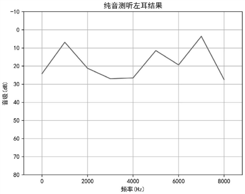 User adaptive hearing aid self-fitting method based on neural network