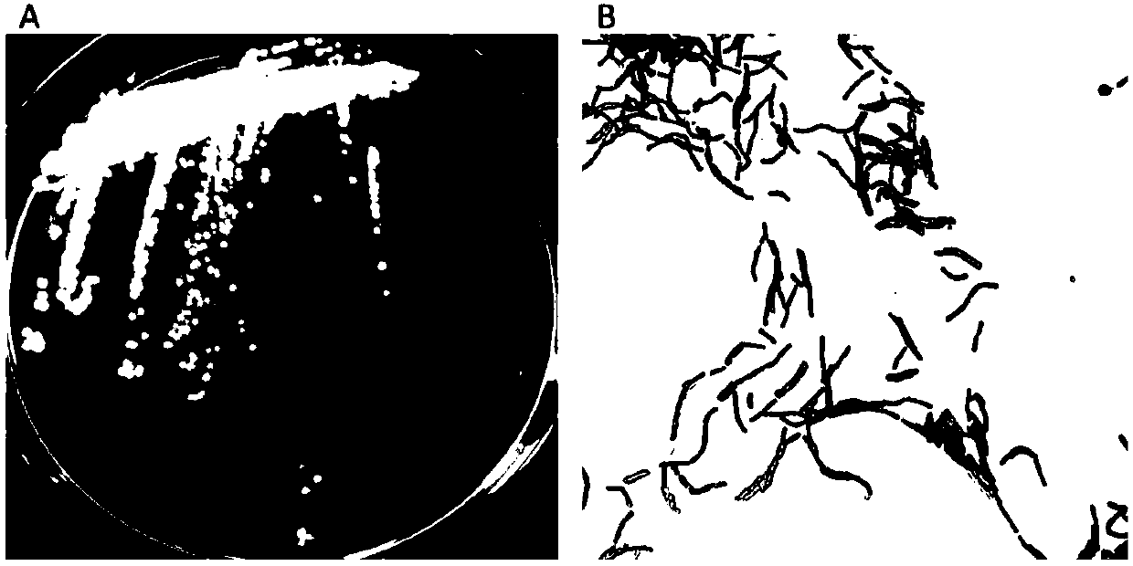 Bacillus addisoni capable of producing neutral raw starch digesting amylase