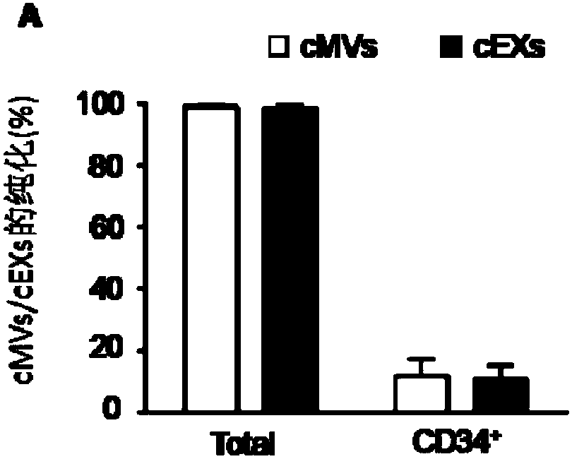 Application of reagents for detecting cd105, cd144, cd34, kdr, annexin V and CD63 in preparation of reagents for detecting extracellular vesicles released by endothelial and endothelial progenitor cells in blood