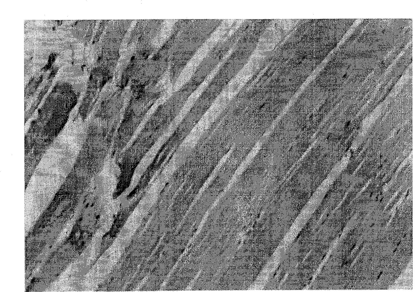 'Yanhuning' frozen-dried powder injection and its preparation method