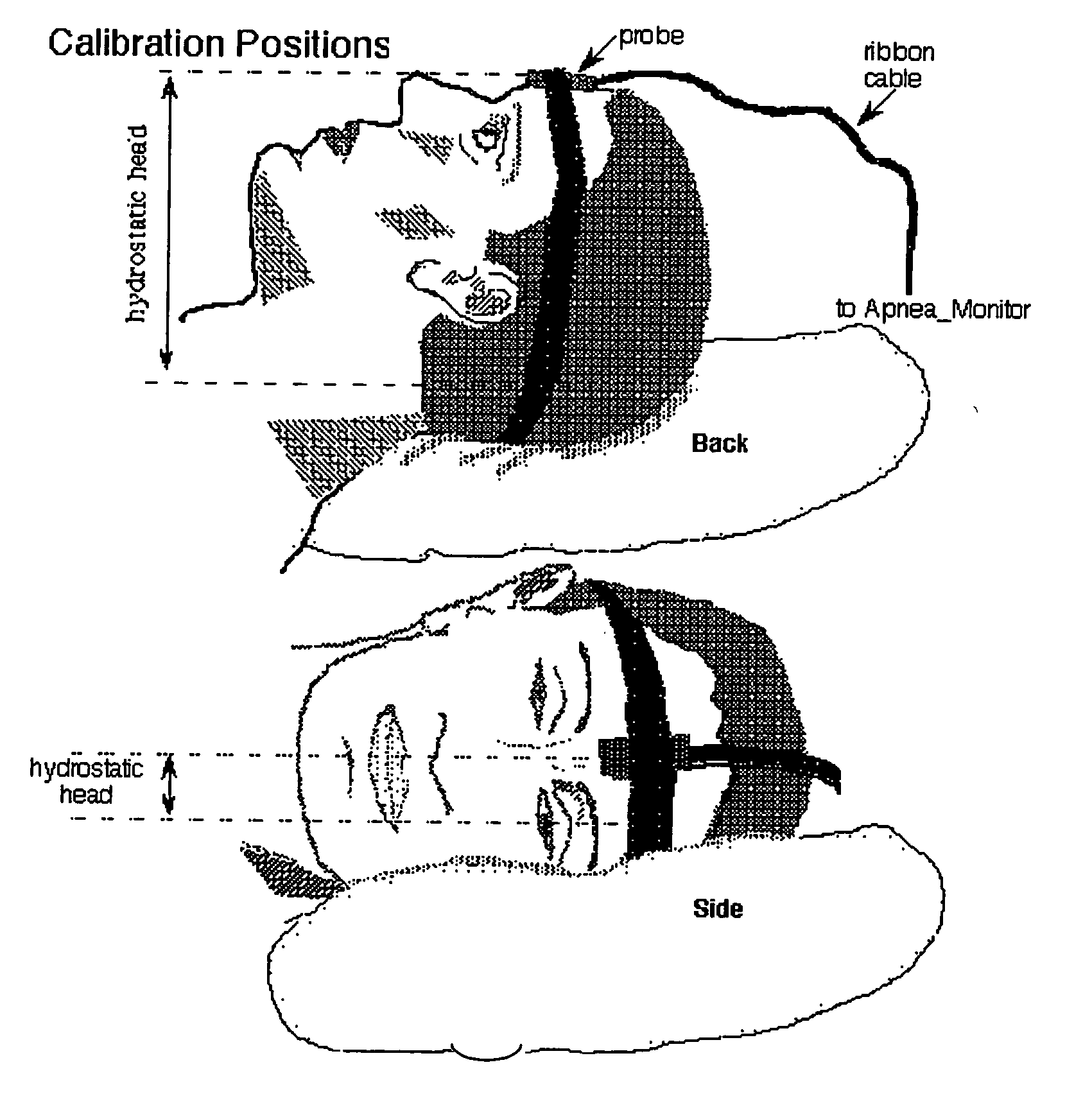 Methods and apparatus for patient monitoring