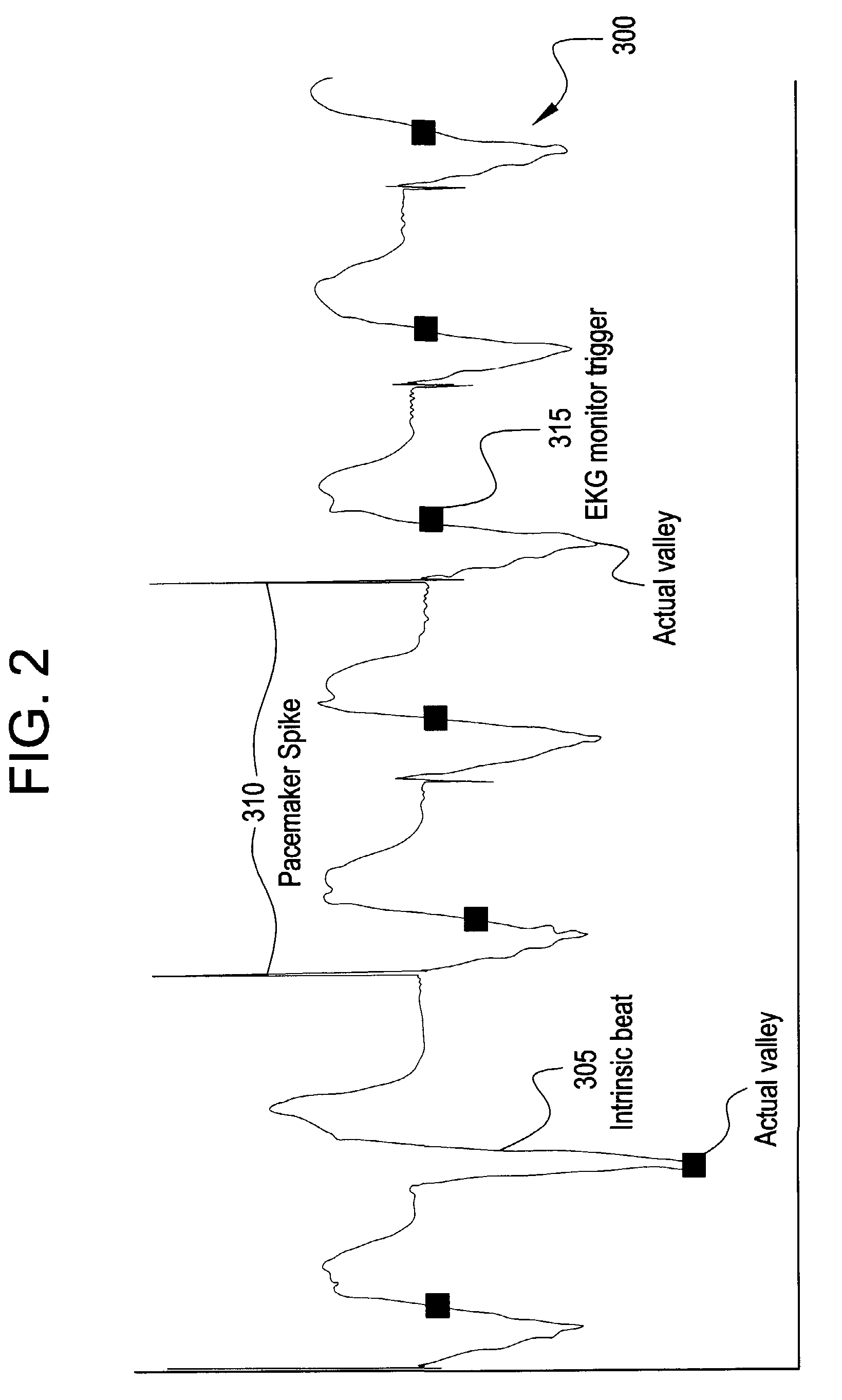 Method, apparatus and product for acquiring cardiac images