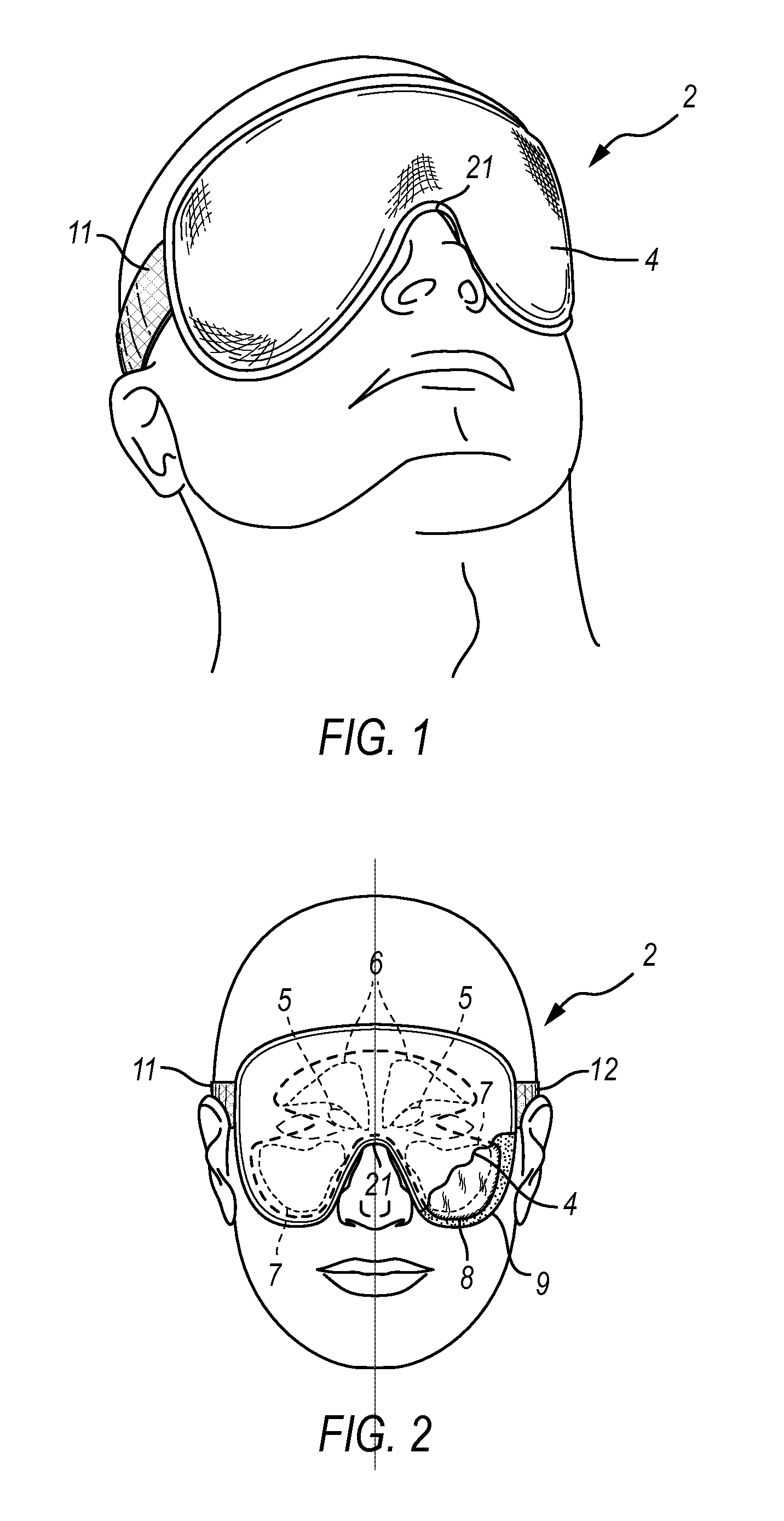 Method and therapeutic apparatus for normalizing function of sinus cilia using heat