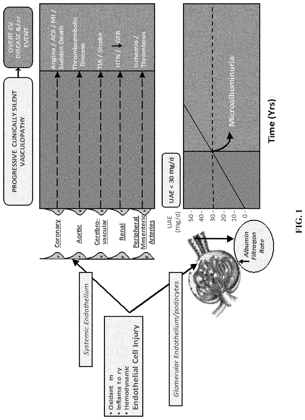 Determination of risk for development of cardiovascular disease by measuring urinary levels of podocin and nephrin messenger RNA