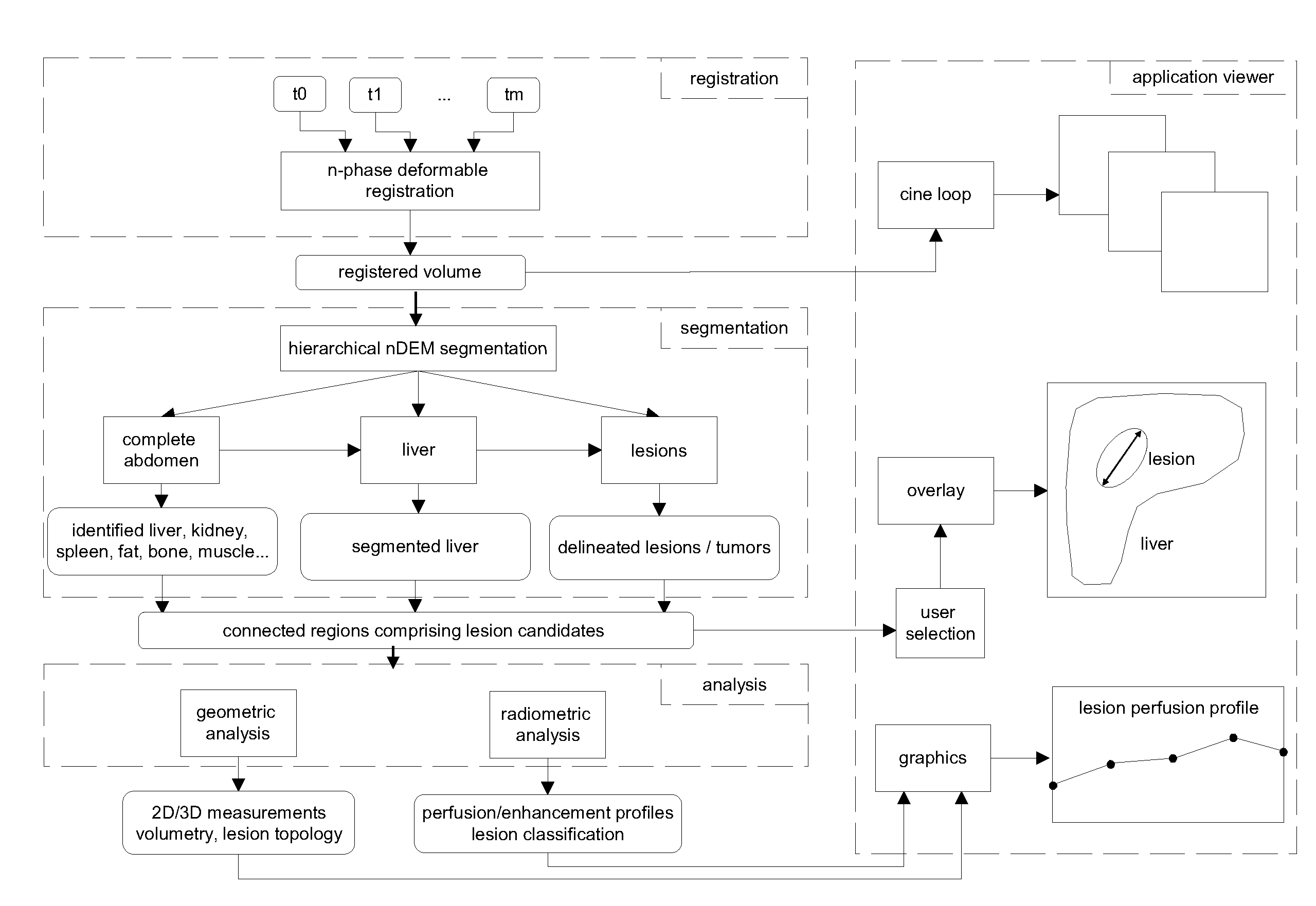 Method and system for lesion segmentation