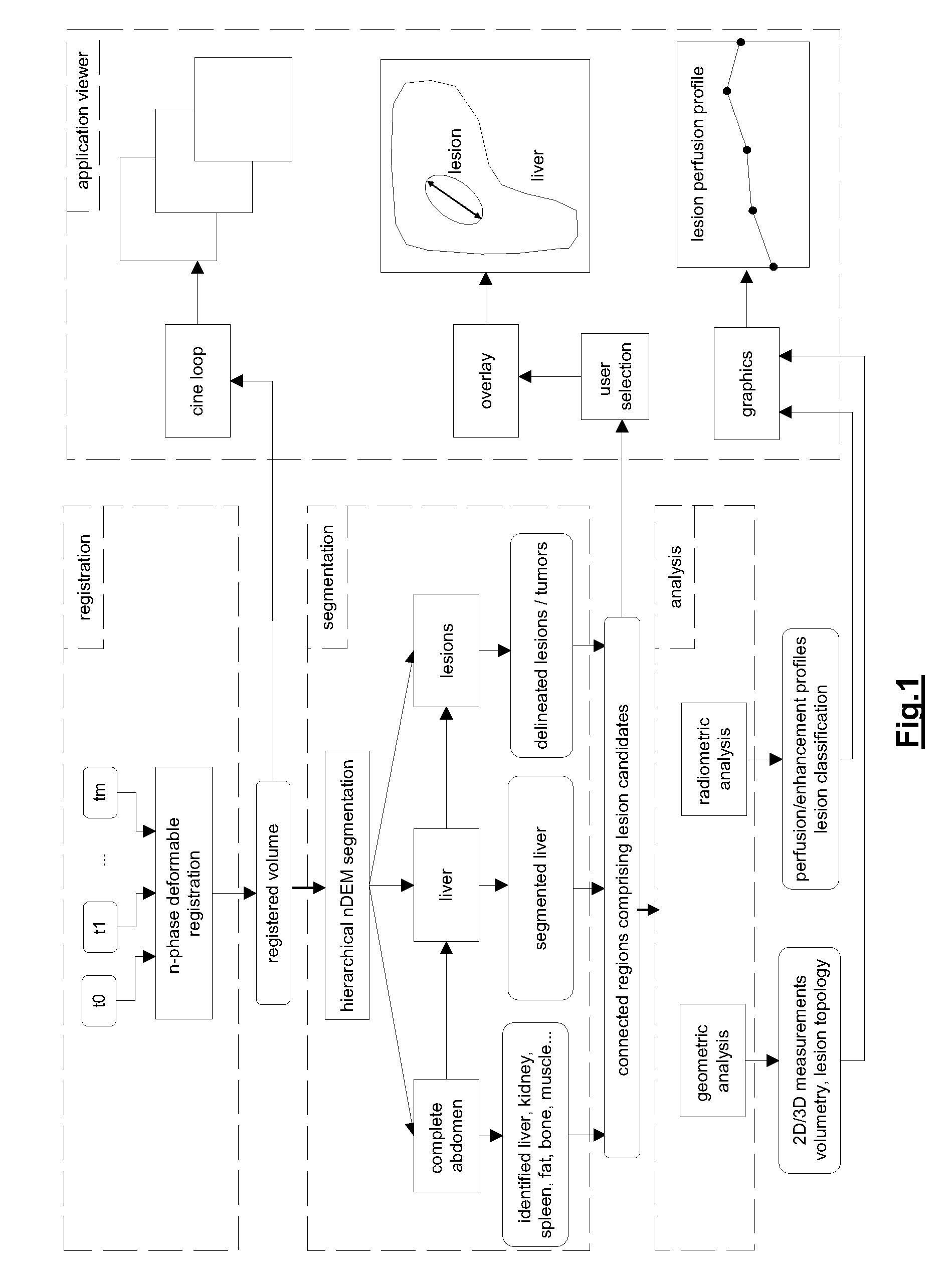 Method and system for lesion segmentation