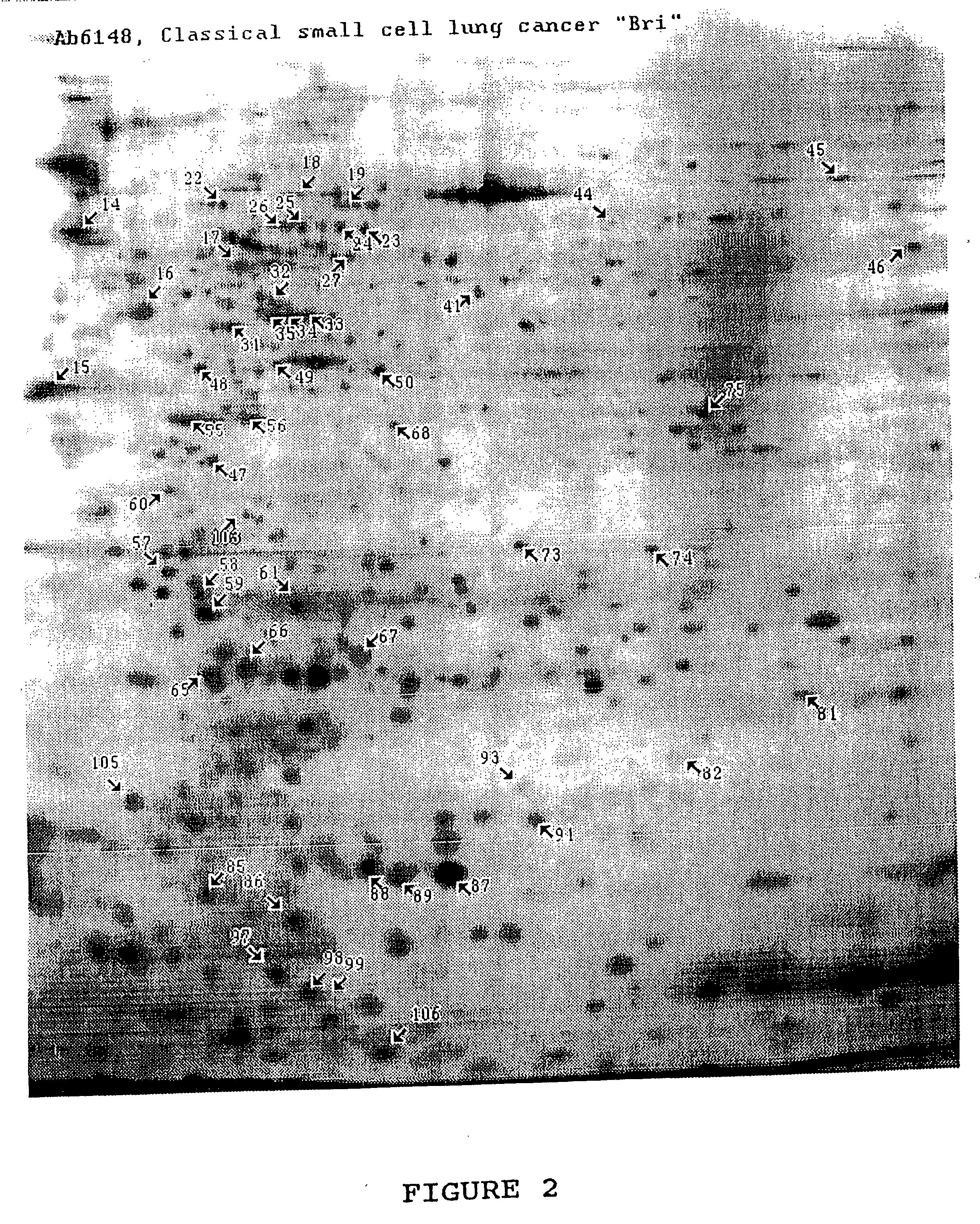 Protein markers for lung cancer and use thereof