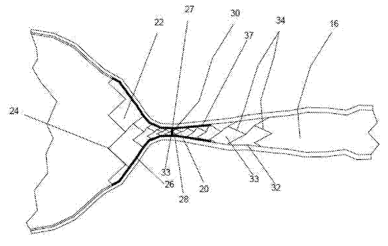 Fallopian Tube Occluding Device, Delivery Catheter and Method