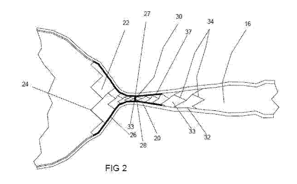 Fallopian Tube Occluding Device, Delivery Catheter and Method