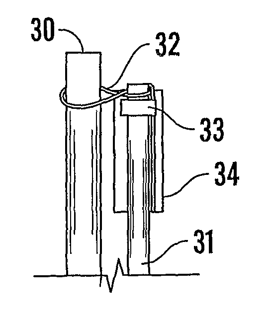 Endoluminal surgical delivery system