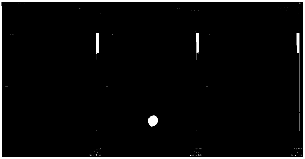 A [18f]alf-labeled pet polypeptide probe and its preparation method