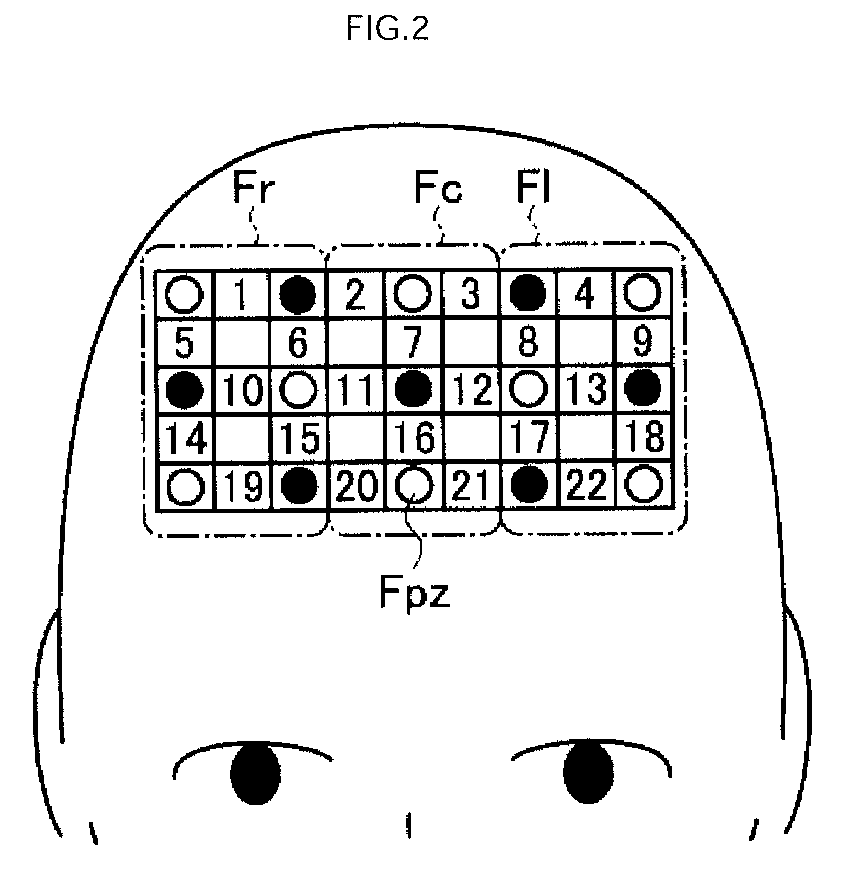 Cognitive impairment determination apparatus, cognitive impairment determination system and program