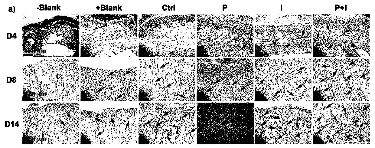 Photo-thermal-ion synergistic antibacterial hydrogel as well as preparation method and application thereof