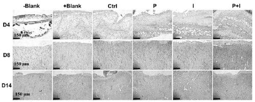 Photo-thermal-ion synergistic antibacterial hydrogel as well as preparation method and application thereof