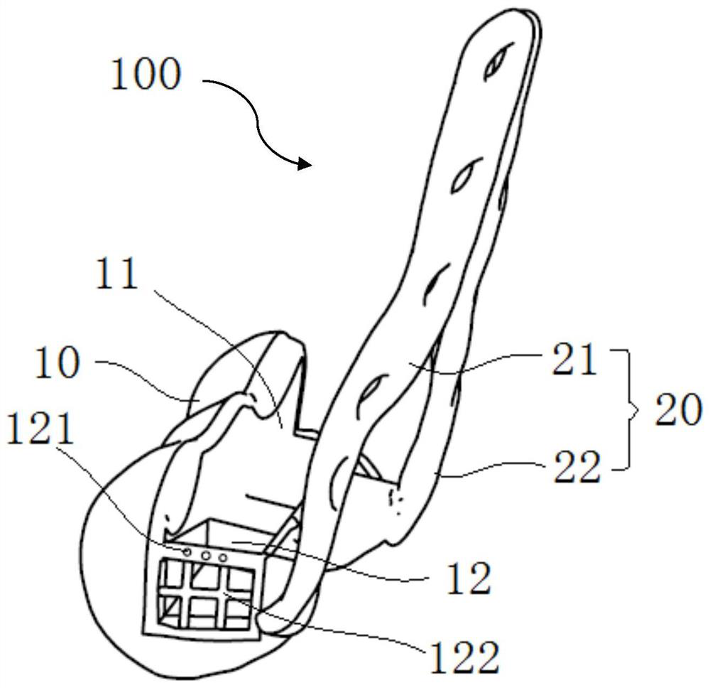 Superficial replacement prosthesis for elbow joint