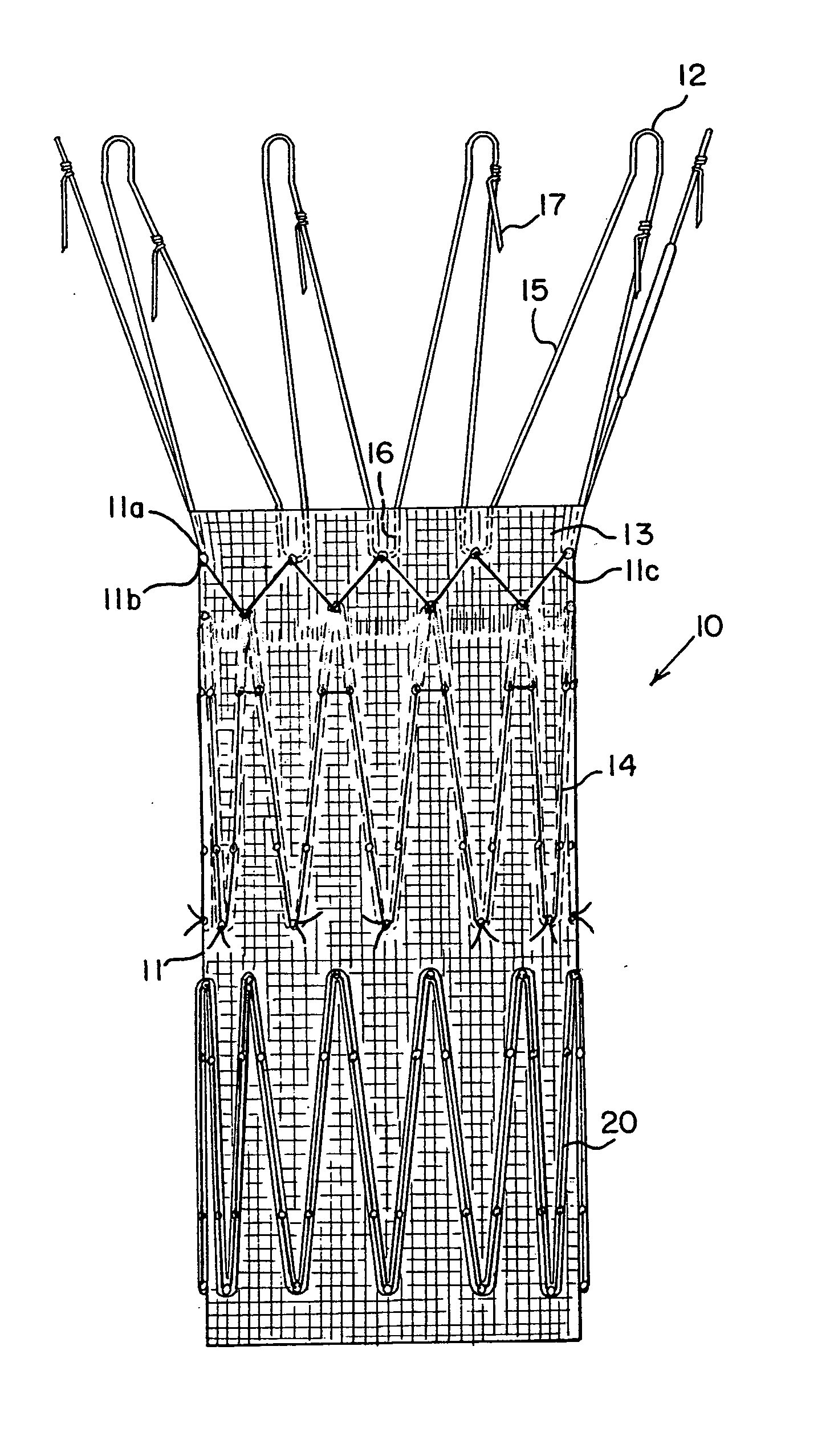 Endoluminal prosthetic device