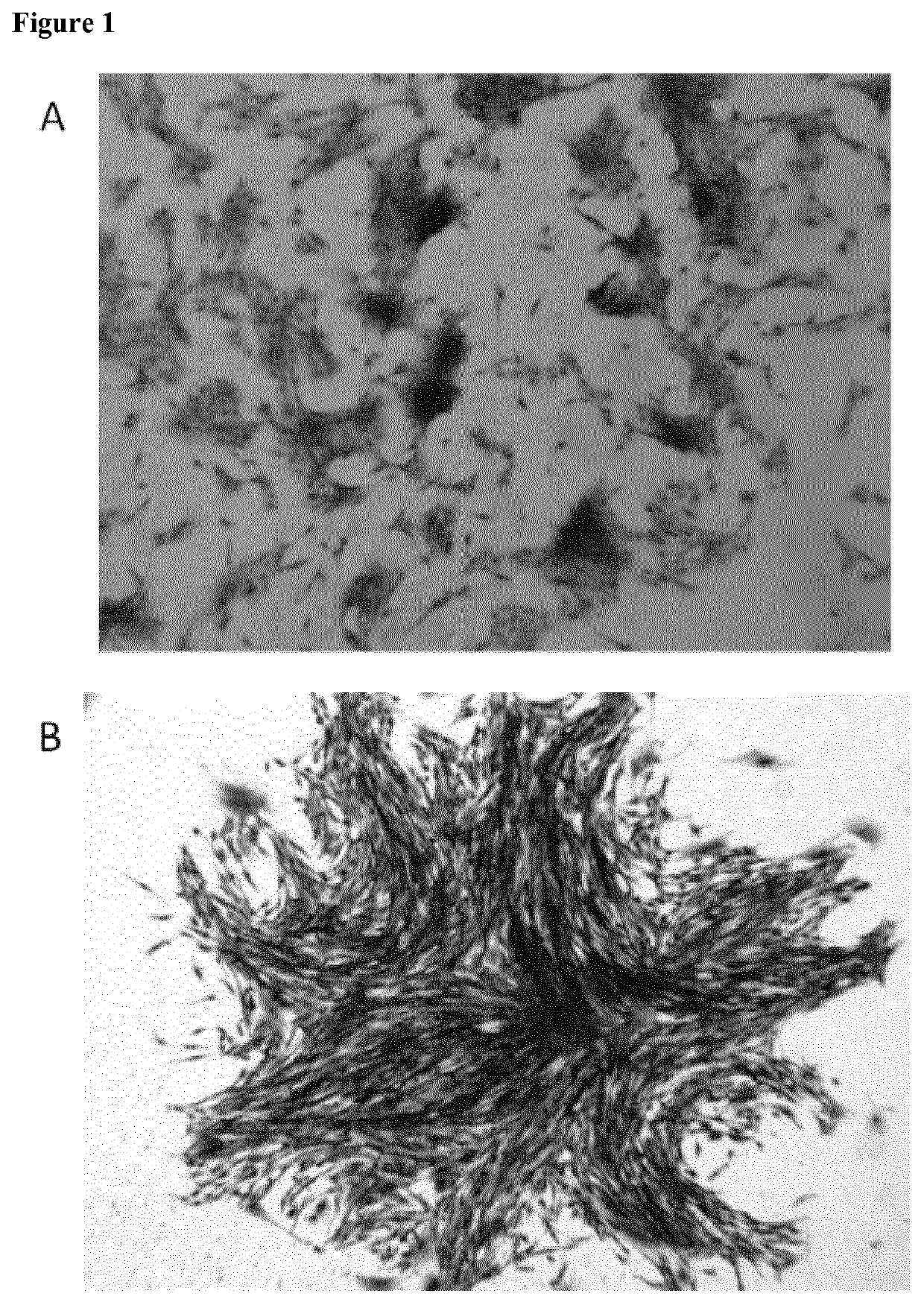 Mammalian muscle-derived stem cells