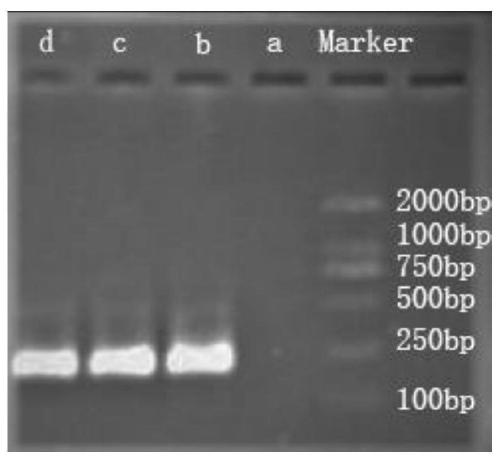 Method for detecting and counting biomass of acaudina molpadioides larvae in seawater