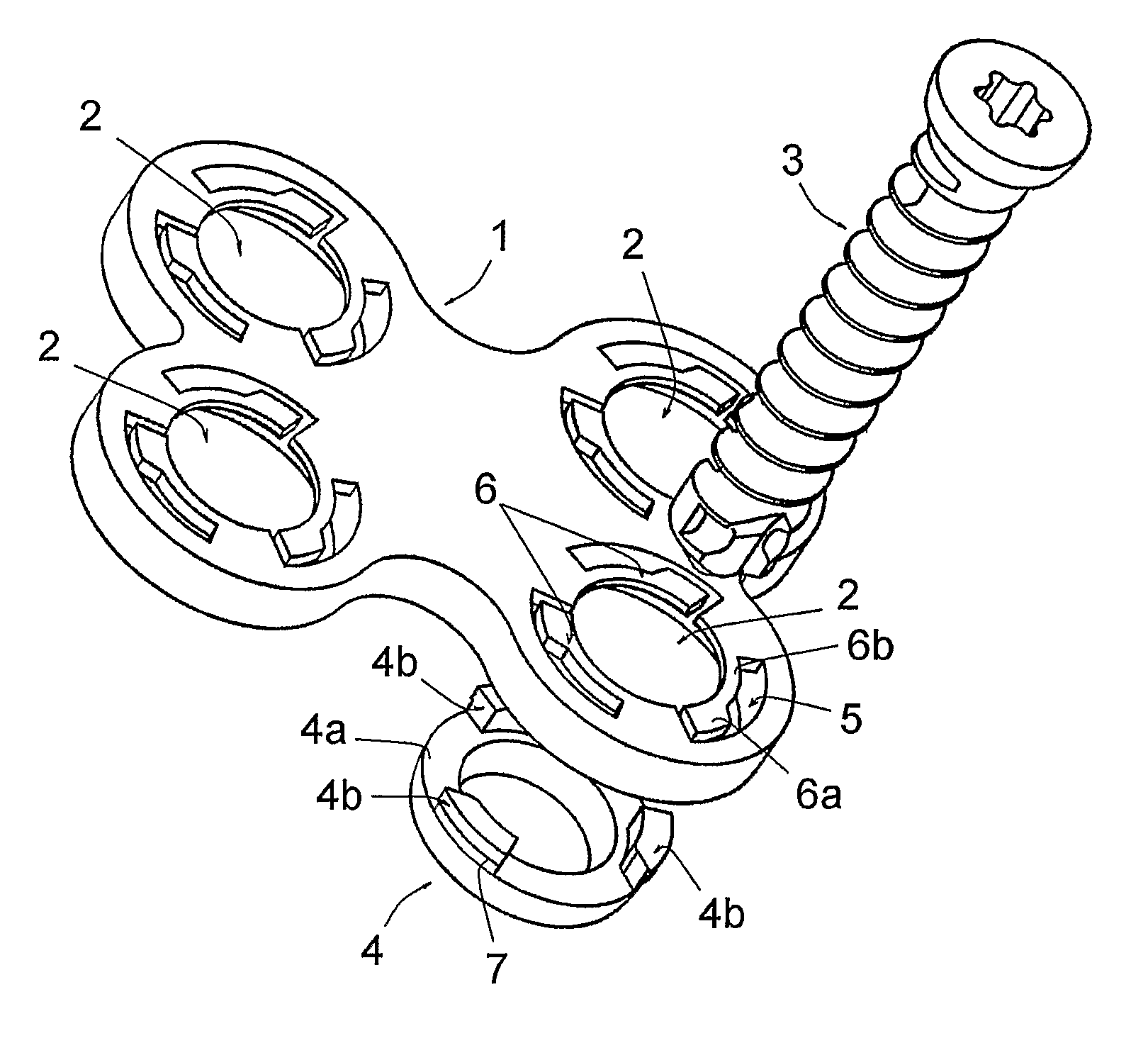 Osteosynthesis plate