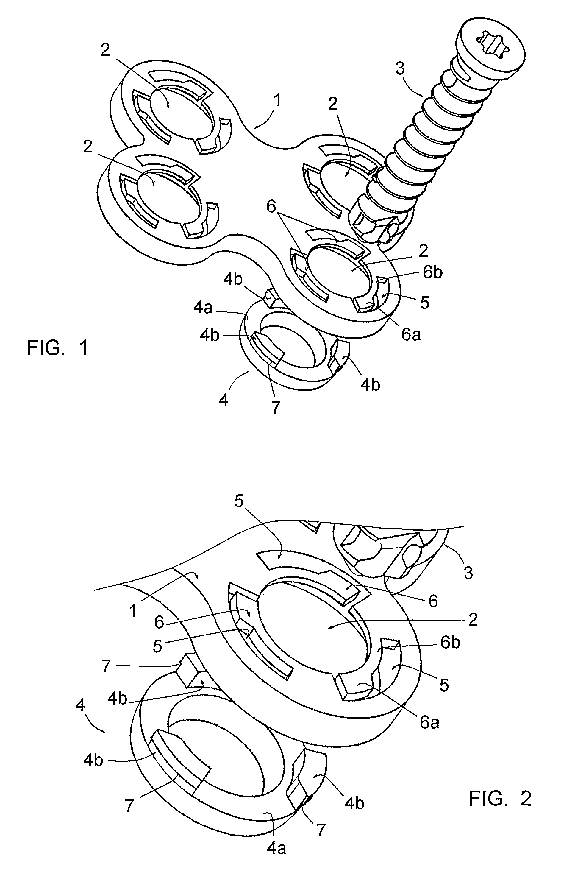 Osteosynthesis plate