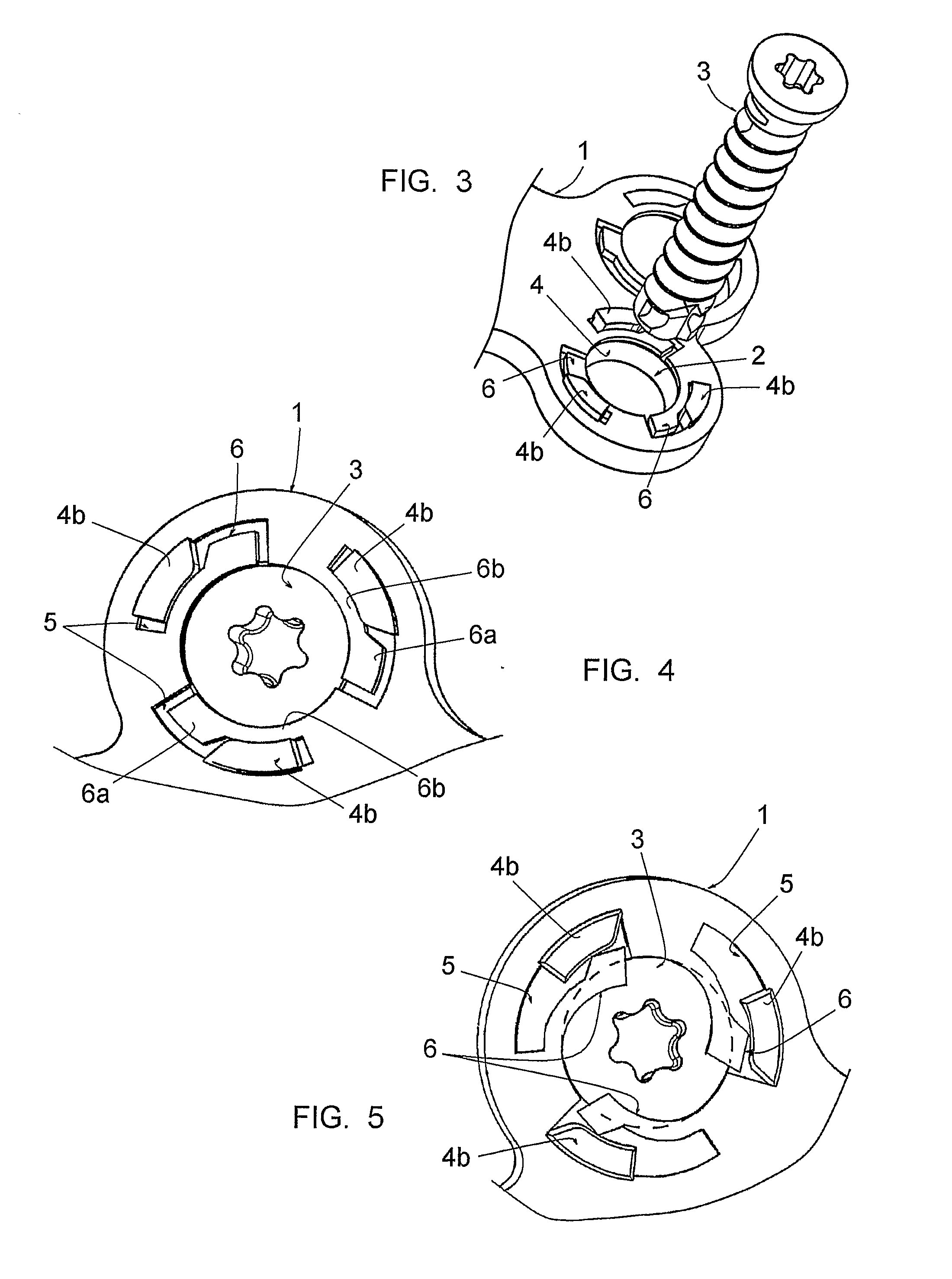 Osteosynthesis plate