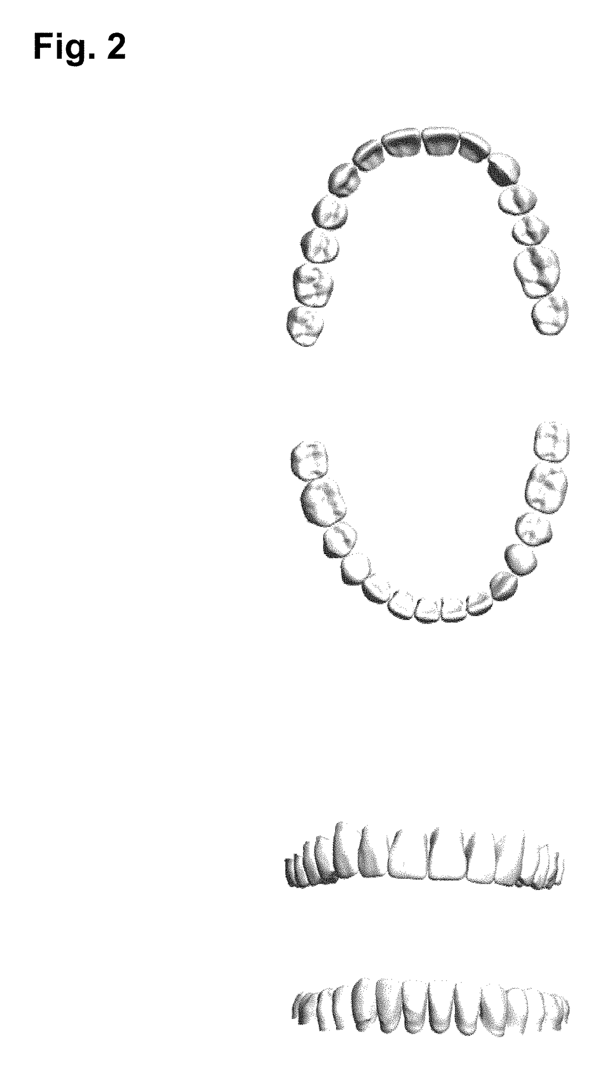 Photo-curable resin compositions and method of using the same in three-dimensional printing for manufacturing articifial teeth and denture base