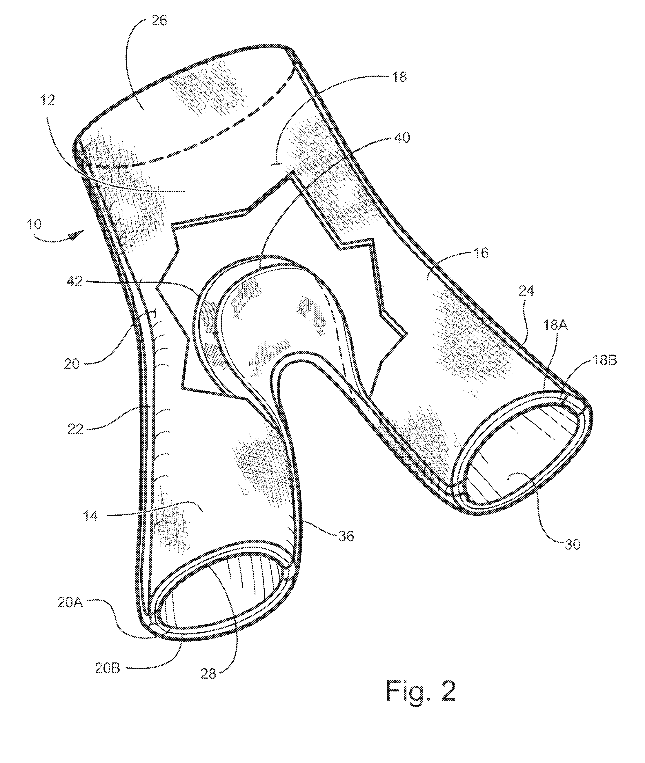 Hip spica cast and undergarment for use with hip spica cast