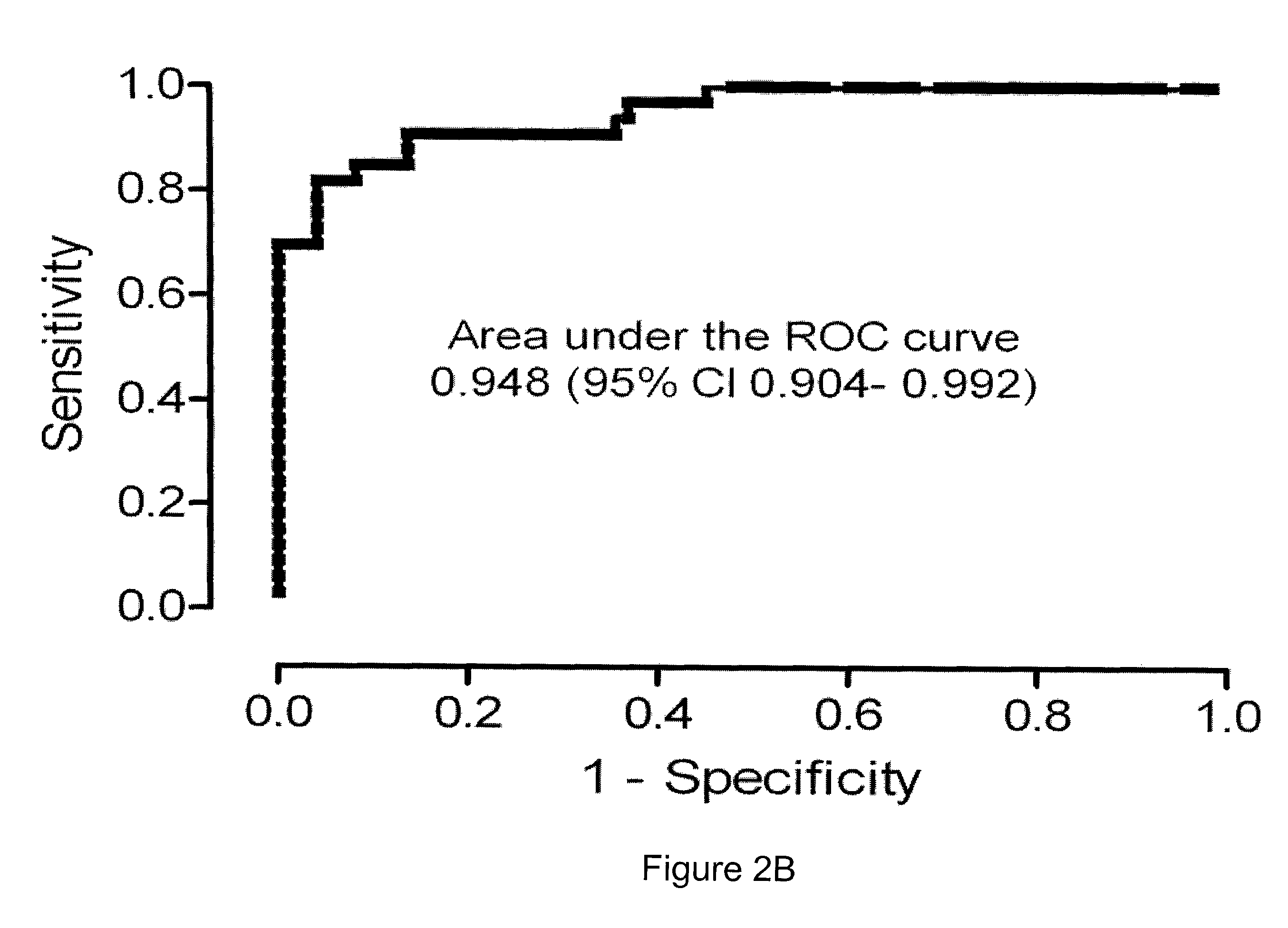 Use of VEGF-D in the diagnosis of lymphangioleiomyomatosis (LAM) disease