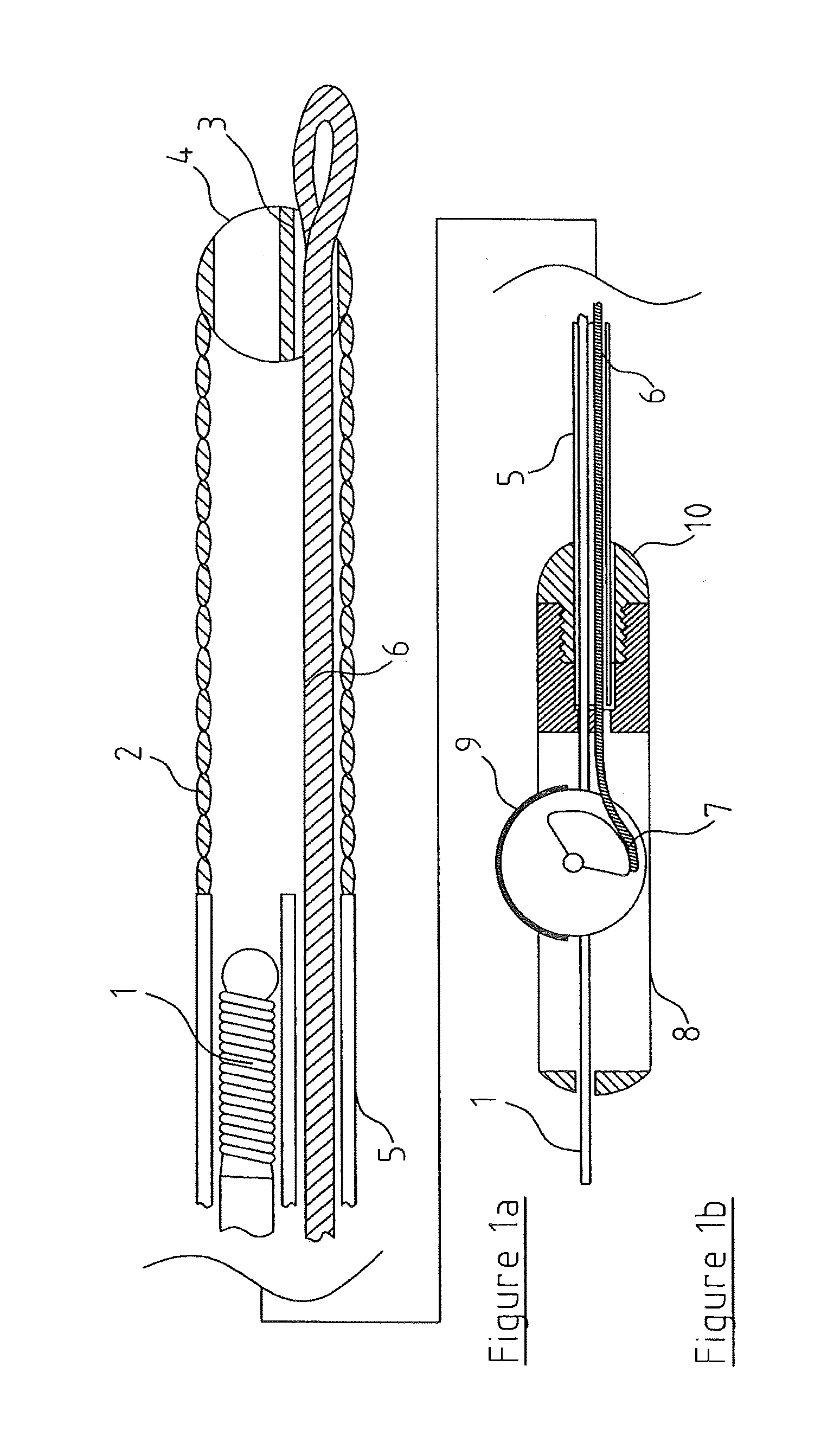 Angioplasty assembly