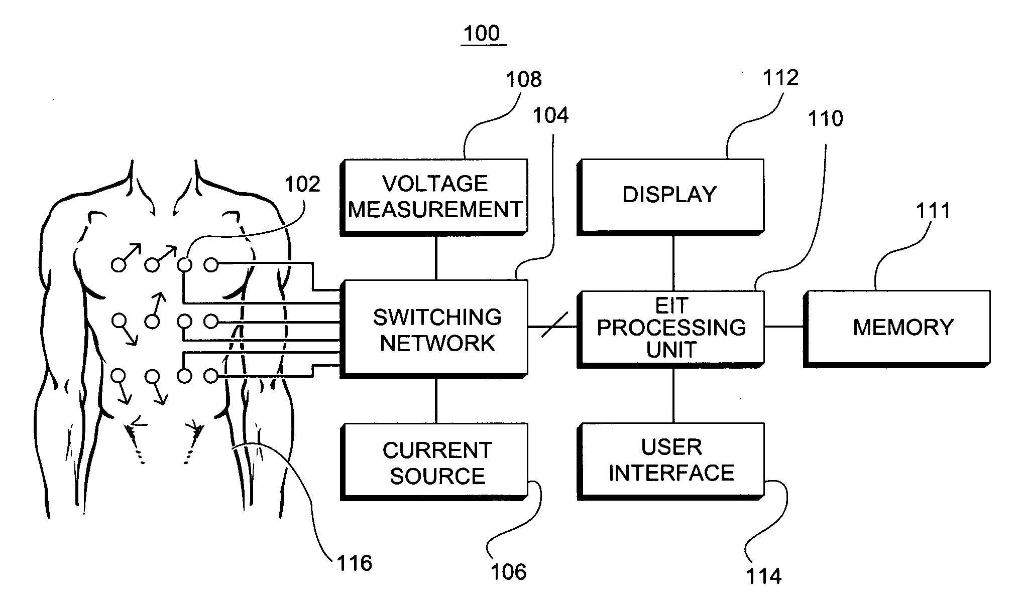 Electrical impedance tomography using a virtual short measurement technique