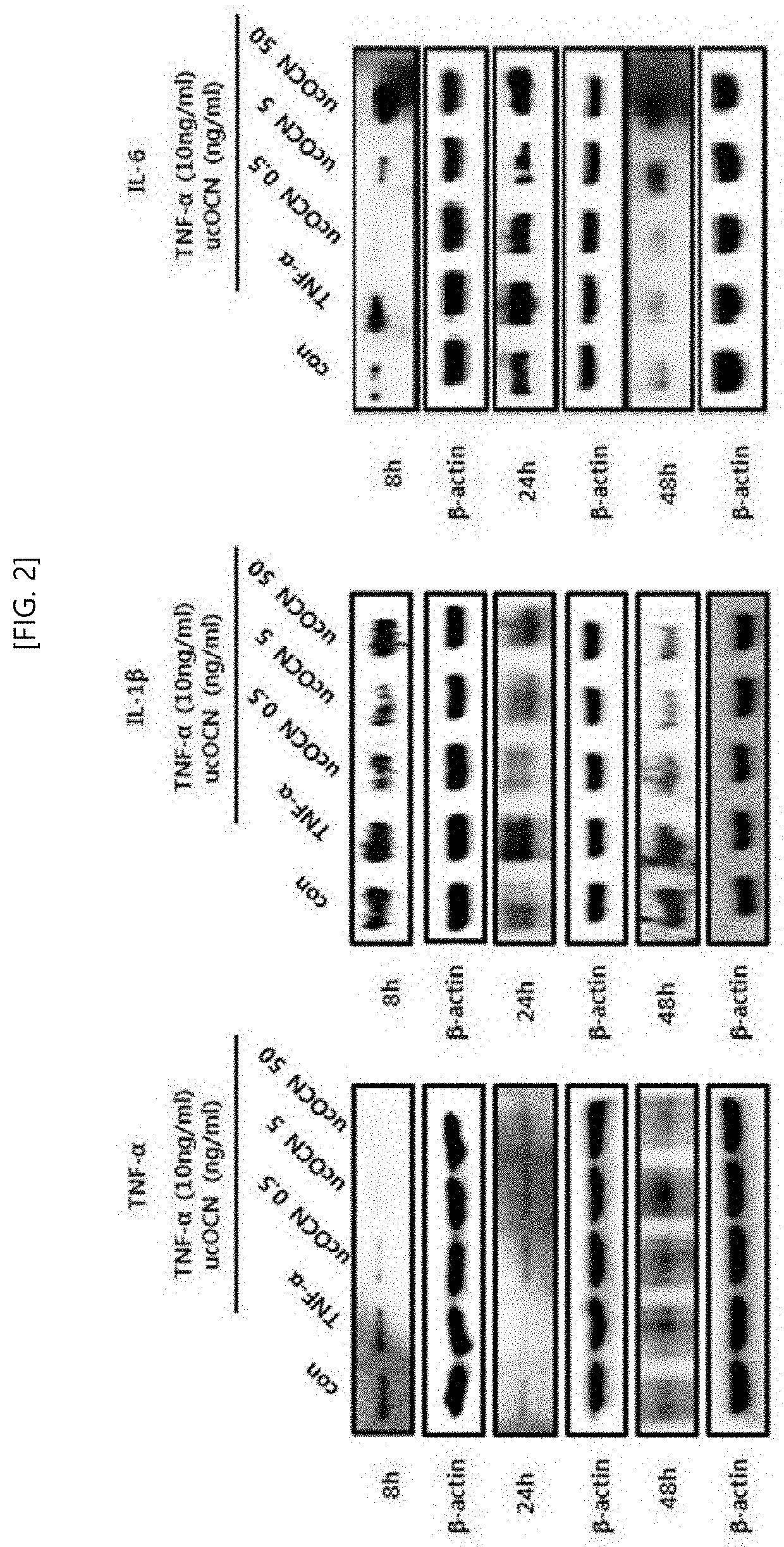 Pharmaceutical composition, for preventing or treating inflammatory diseases, comprising osteocalcin