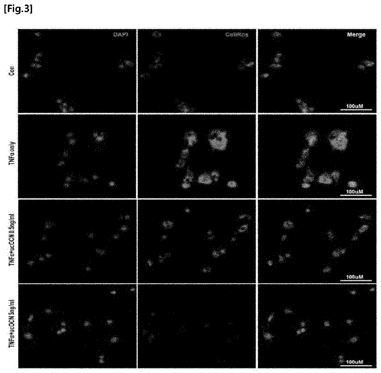 Pharmaceutical composition, for preventing or treating inflammatory diseases, comprising osteocalcin