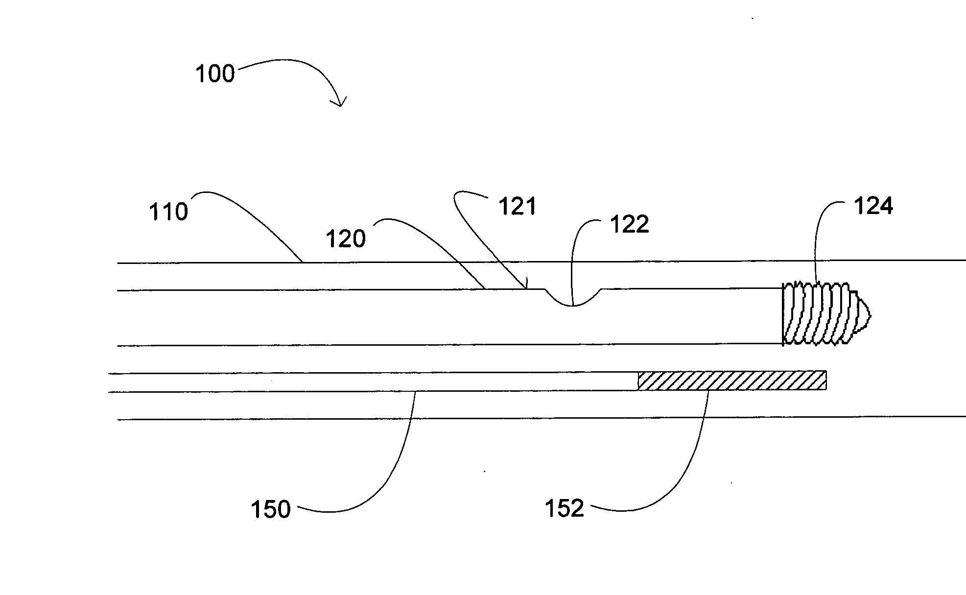 Neurovascular intervention device