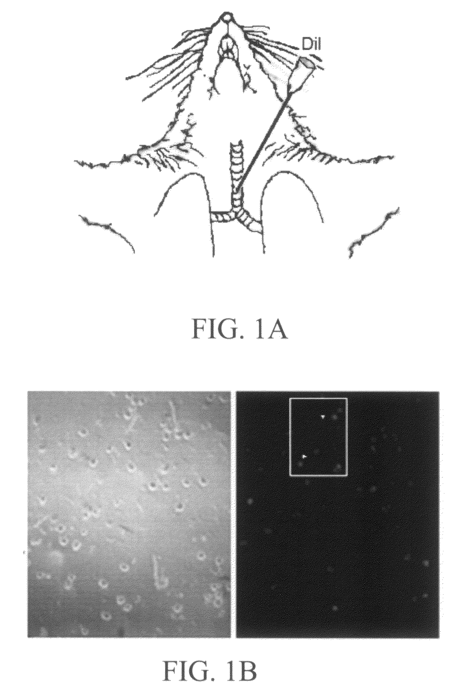 Methods and Systems for Treating Asthma and Other Respiratory Diseases