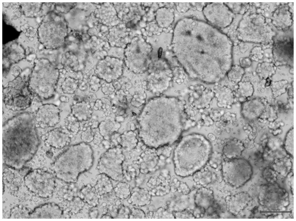 Culture method of gynecological tumor primary cells