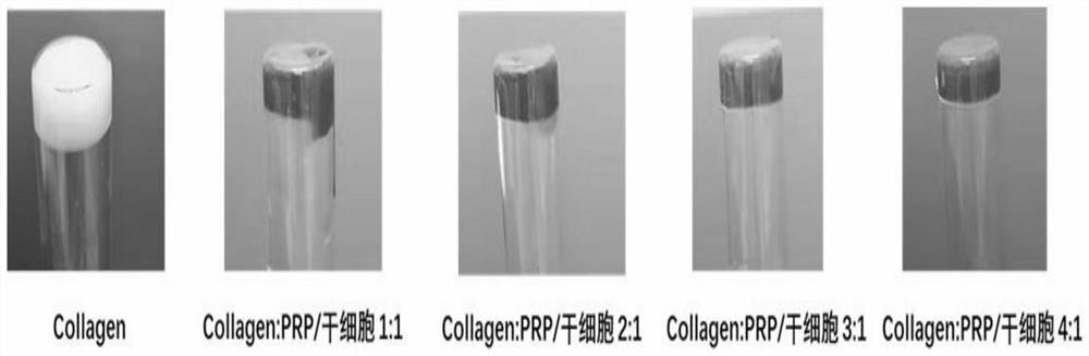 Preparation method and application of temperature-sensitive composite hydrogel preparation for endometrial repair