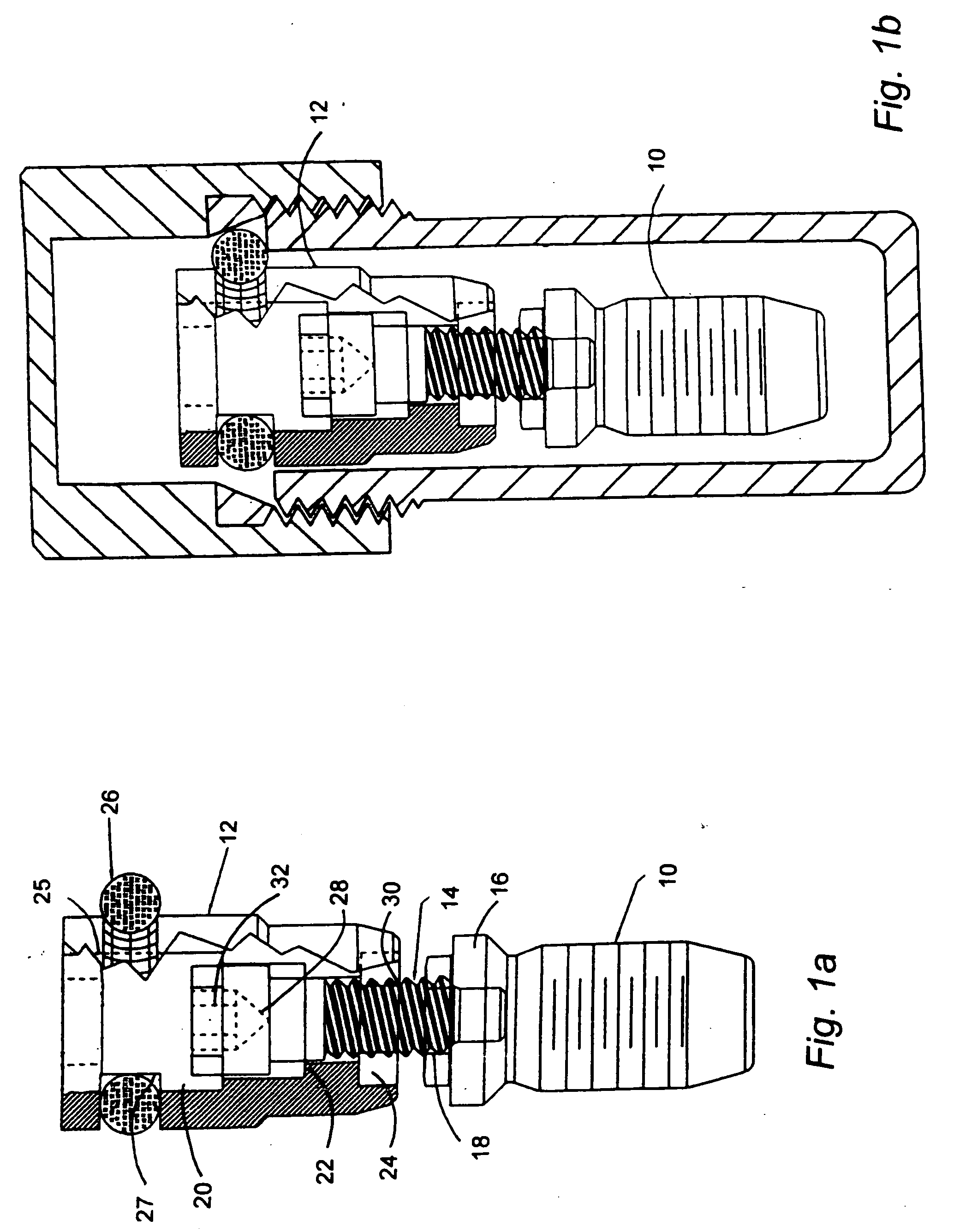 Implant delivery system