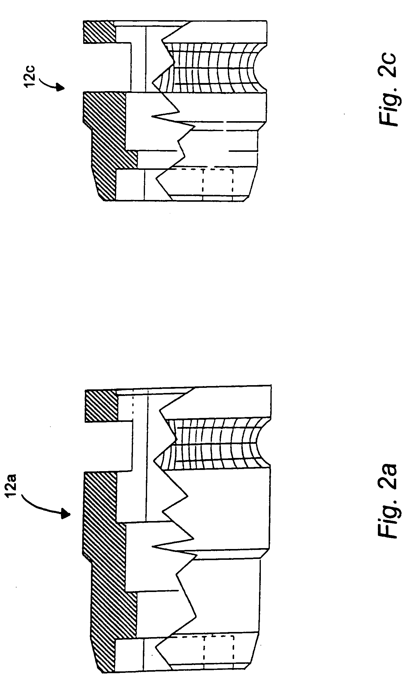 Implant delivery system