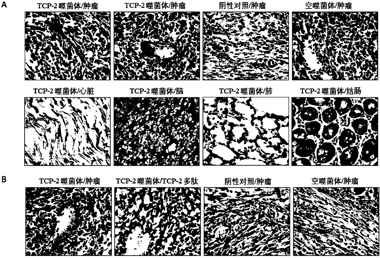 Tumor blood vessel and M1 type macrophage targeting peptide and application thereof