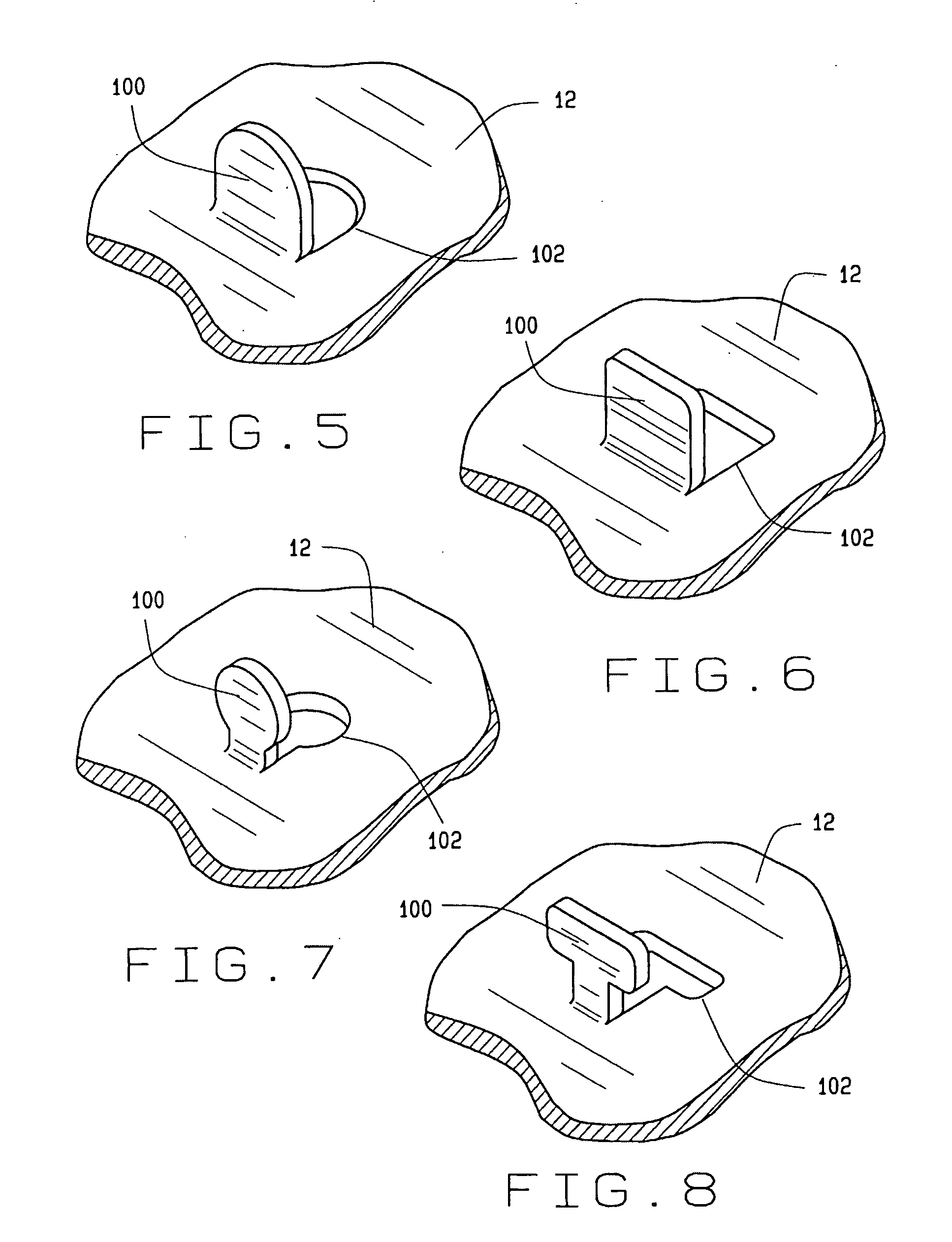 High friction brake shoe assembly