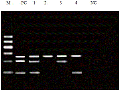 A kind of legionella rapid detection and typing kit and its detection method