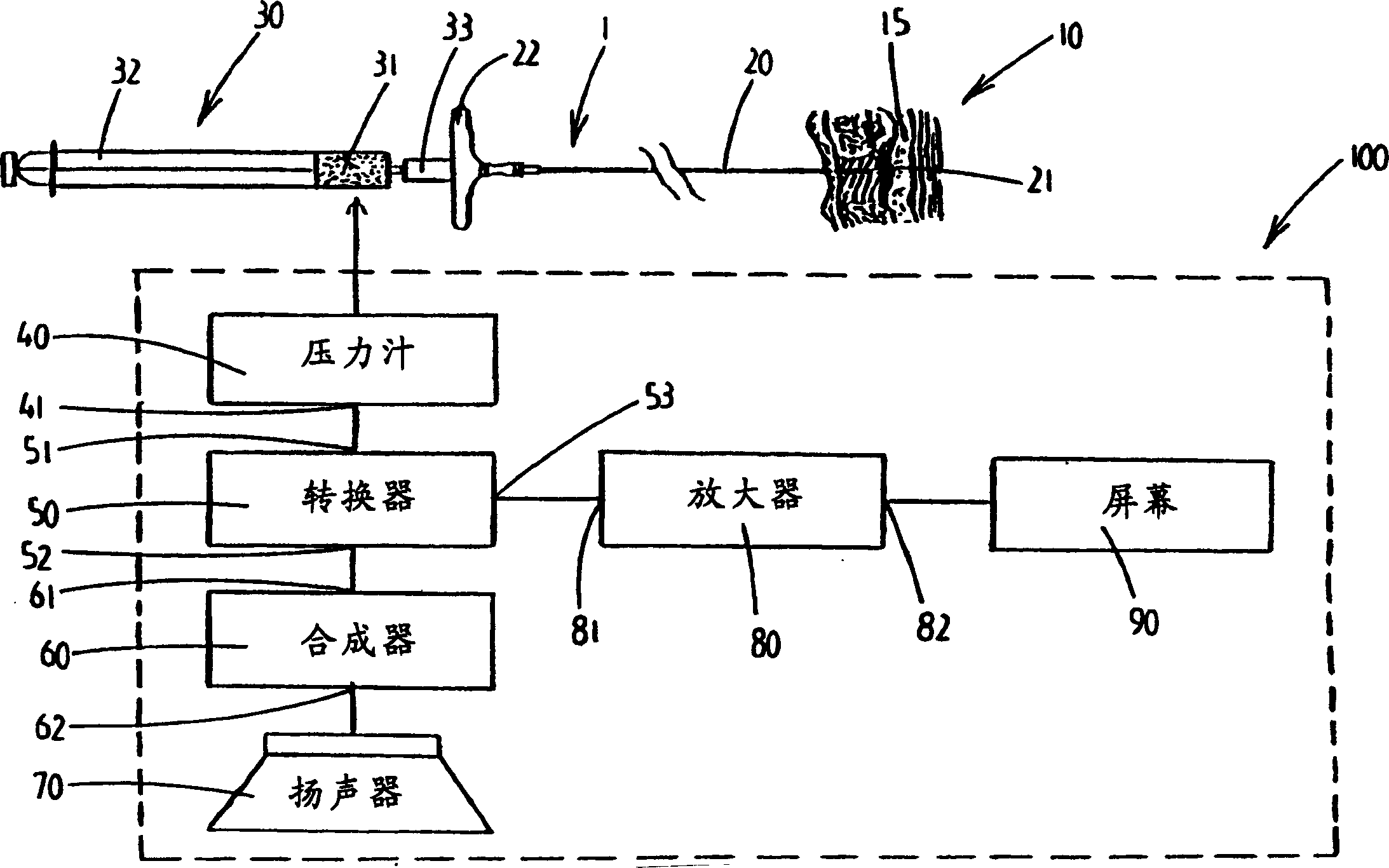 Device for locating an anatomical cavity in a body and device for measuring and transmitting signal