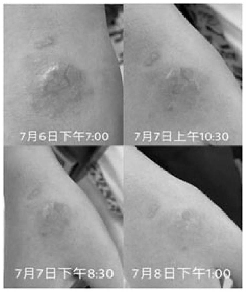 Protein film dressing beneficial to wound healing based on cooperation of three bioactive scaffold materials and cytotrophic factors